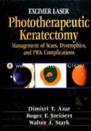 Excimer Laser Phototherapeutic Keratectomy: Phototherapeutic Keratectomy image