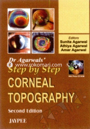 Step By Step Corneal Topography image