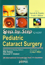 Step By Step Pediatric Cataract Surgery image