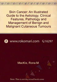 Skin Cancer: An Illustrated Guide To The Aetiology, Clinical Features, Pathology And Management Of Benign And Malignant Cutaneous Tumours image