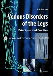 Venous Disorders of the Legs : Principles and Practice image