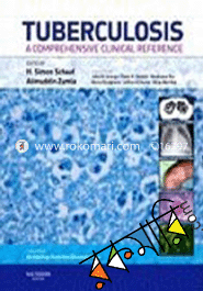 Tuberculosis : A Comprehensive Clinical Reference image