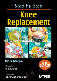 Step by Step Knee Replacement (With DVD-ROM) image
