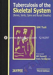 Tuberculosis of the Skeletal System image
