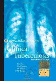 Clinical Tuberculosis image