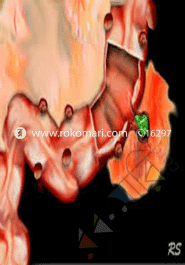 CT and Sonography of the Acute Abdomen image