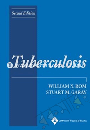Tuberculosis