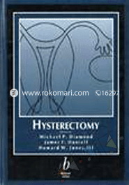 Hysterectomy image