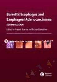 Barrett's Esophagus and Esophageal Adenocarcinoma image