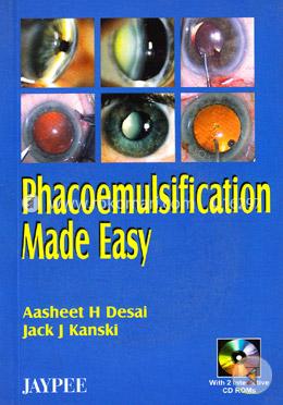 Phacoemulsification Made Easy image
