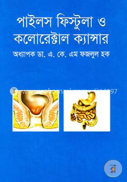 পাইলস ফিস্টুলা ও কলোরেক্টাল ক্যান্সার
