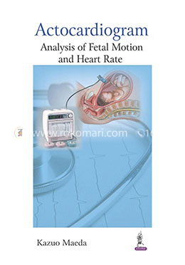 Actocardiogram: Analysis of Fetal Motion and Heart Rate