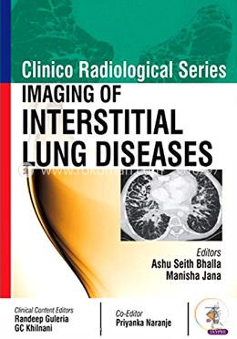 Clinico Radiological Series: Imaging of Interstitial Lung Diseases