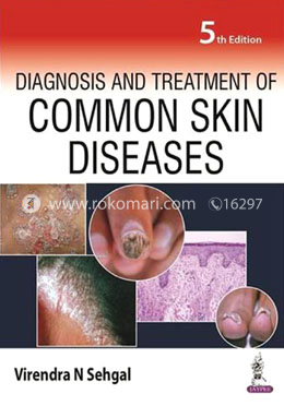 Diagnosis and Treatment of Common Skin Diseases