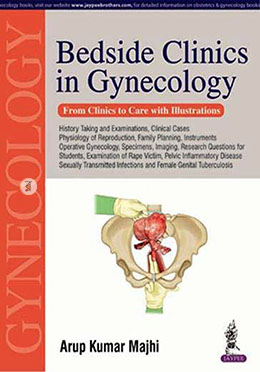 Bedside Clinics in Gynecology