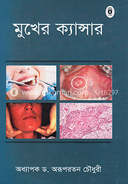 মুখের ক্যান্সার image
