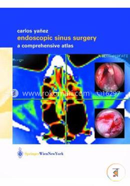 Endoscopic Sinus Surgery: A Comprehensive Atlas