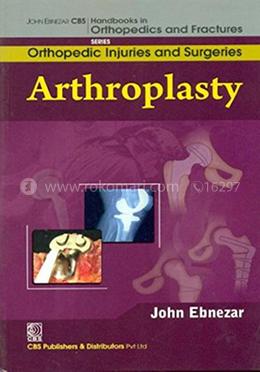 Arthroplasty - (Handbooks in Orthopedics and Fractures Series, Vol. 62 - Orthopedic Injuries and Surgeries)