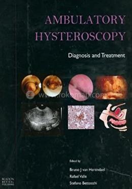 Ambulatory Hysteroscopy
