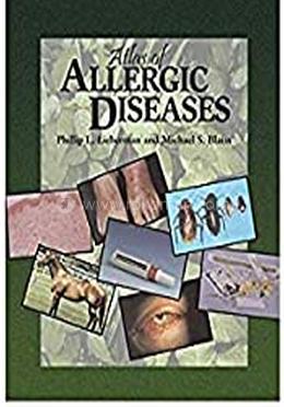 Atlas of Allergic Diseases