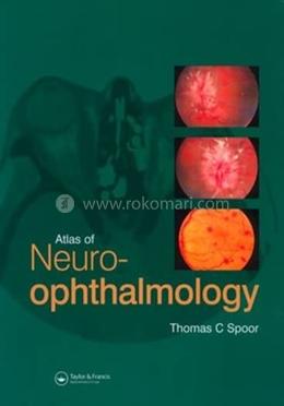 Atlas of Neuro-Ophthalmology