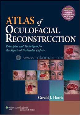Atlas of Oculofacial Reconstruction