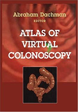Atlas of Virtual Colonoscopy