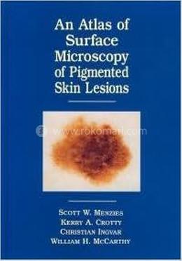 Atlas of the Surface Microscopy of Pigmented Skin Tumour