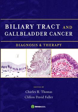 Biliary Tract and Gallbladder Cancer