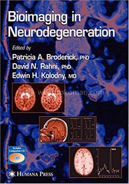 Bioimaging in Neurodegeneration