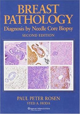 Breast Pathology