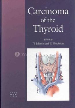 Carcinoma of the Thyroid 