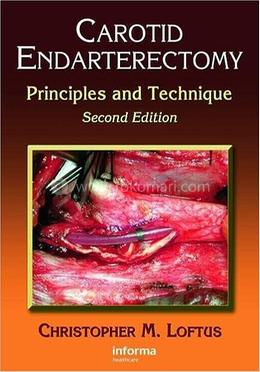 Carotid Endarterectomy