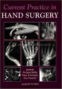 Current Practice in Hand Surgery