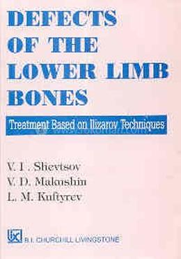 Defects Of The Lower Limb Bones