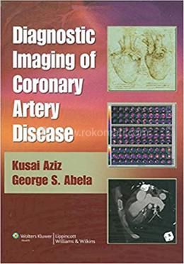 Diagnostic Imaging of Coronary Artery Disease