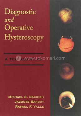 Diagnostic and Operative Hysteroscopy: A Text and Atlas