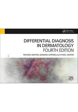 Differential Diagnosis in Dermatology