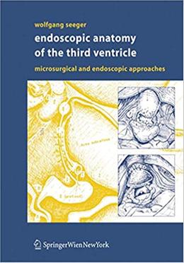 Endoscopic Anatomy of the Third Ventricle