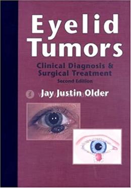 Eyelid Tumors