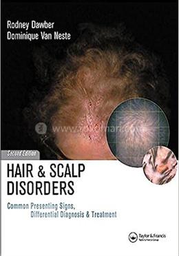 Hair and Scalp Disorders
