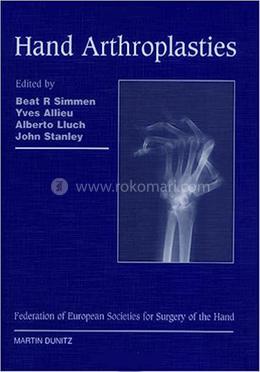 Hand Arthroplasties