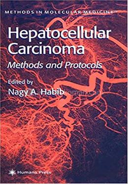 Hepatocellular Carcinoma