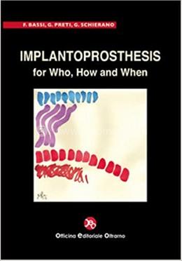 Implantoprosthesis For Who, How And When