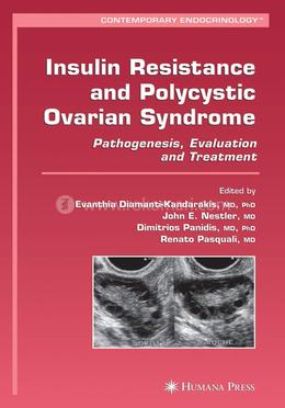Insulin Resistance and Polycystic Ovarian Syndrome: Pathogenesis, Evaluation, and Treatment (Contemporary Endocrinology)