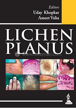 Lichen Planus