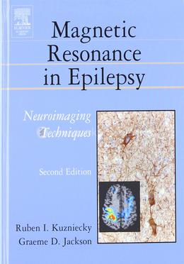 Magnetic Resonance in Epilepsy