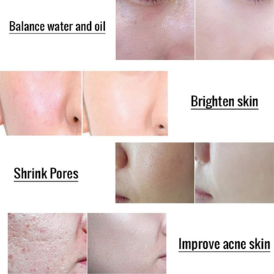 Melao Glycolic Acid Peel Serum 70 Percent - 30 ml - 6695224327534 Slide 4