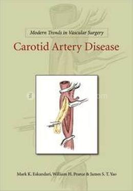 Modern Trends In Vascular Surgery: Carotid Artery Disease / Edition 1