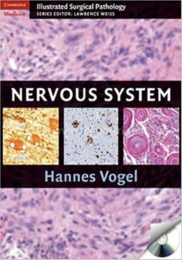 Nervous System